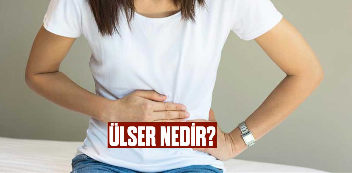 Ülser nedir sorusu, sindirim