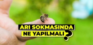 Arı sokmasına karşı ne yapılmalı?