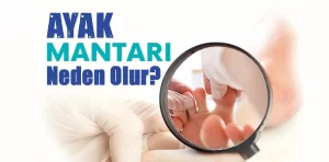 Ayak Mantarı Neden Olur?