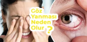 Göz Yanması Neden Olur?