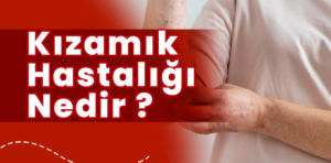 Kızamıkla ilgili temel bilgiler