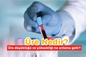 Üre nedir? Üre düşüklüğü ve yüksekliği ne anlama gelir?