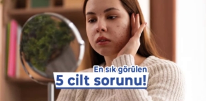 Bugünlerde en sık görülen 5 cilt sorunu!