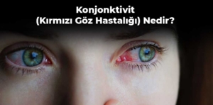 Konjonktivit (Kırmızı Göz Hastalığı) Nedir? Belirtileri Nelerdir?