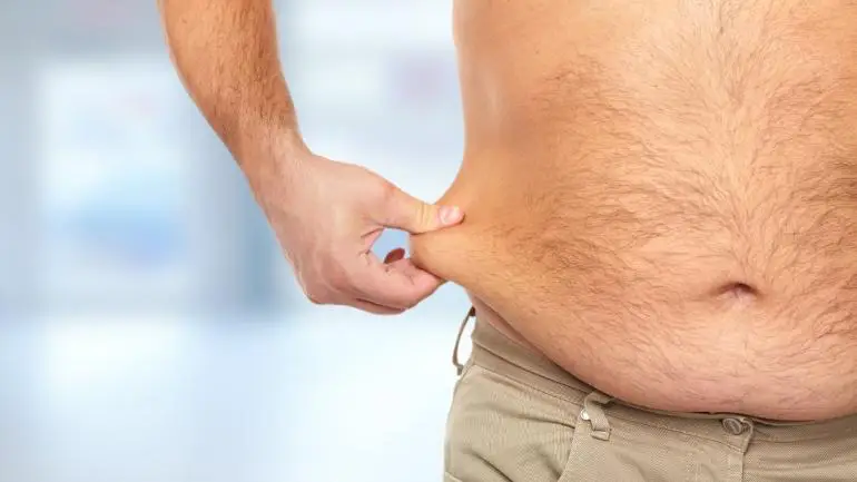 liposuction