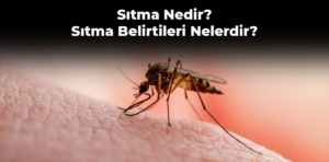 Sıtma Nedir? Sıtma Belirtileri Nelerdir?