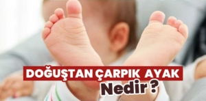 Doğuştan Çarpık Ayak Nedir?