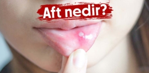 Aft Nedir ve Nasıl Geçer?