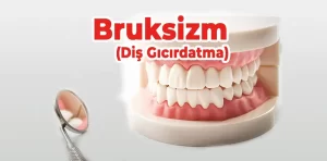 Diş Gıcırdatma (Bruksizm) Nedir? Nasıl Geçer?