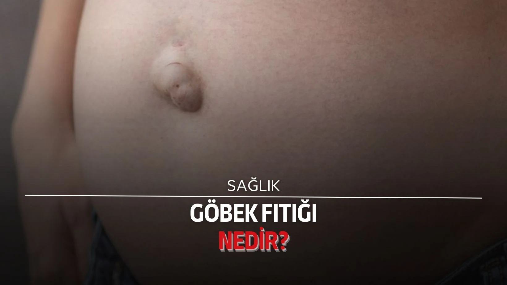 Göbek fıtığı, karın bölgesindeki