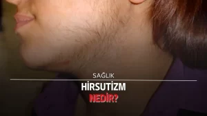 Hirsutizm nedir?