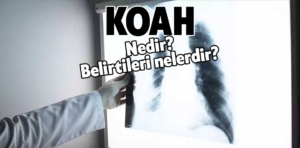 KOAH nedir? KOAH hastalığı belirtileri ve tedavi yöntemleri