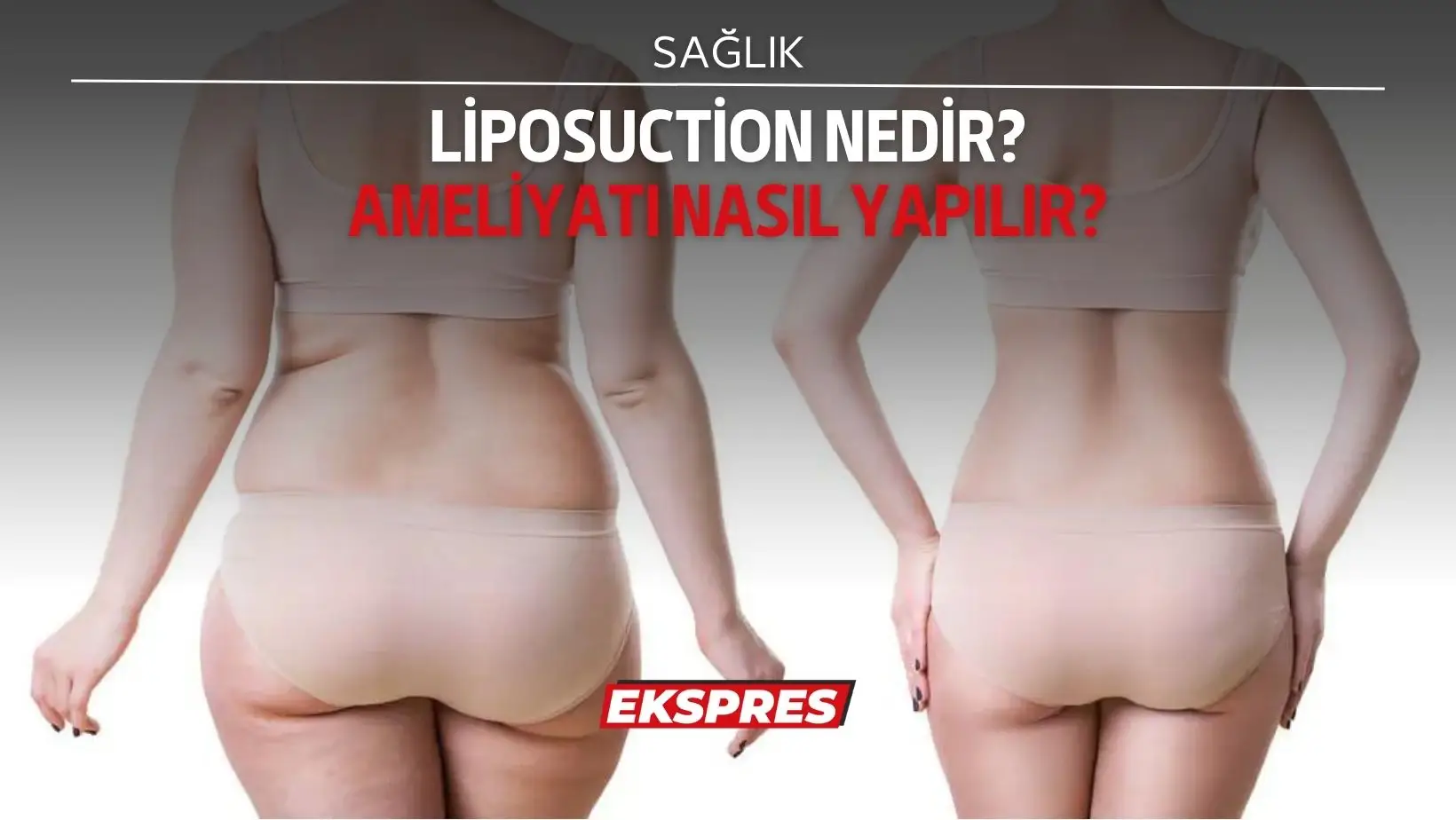 Liposuction kelimesinin kökünü oluşturan