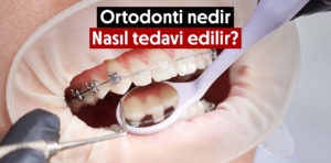 Ortodonti nedir ve nasıl tedavi edilir?