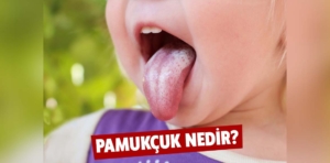 Pamukçuk nedir ve nasıl tedavi edilir?