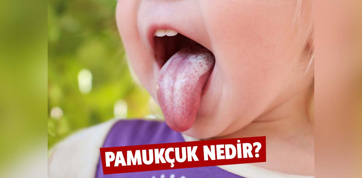 Pamukçuk, bebeklerden yetişkinlere kadar