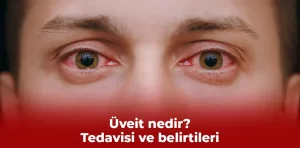 Üveit nedir? Tedavisi ve belirtileri