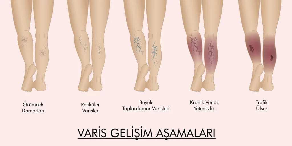 varis gelişim aşamaları