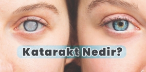 Katarakt nedir?