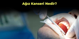 Ağız kanseri nedir? Belirtileri, tedavisi ve risk faktörleri