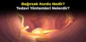 Bağırsak Kurdu Nedir, Tedavi Yöntemleri Nelerdir?