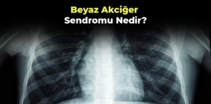 Beyaz akciğer sendromu nedir, belirtileri nelerdir?