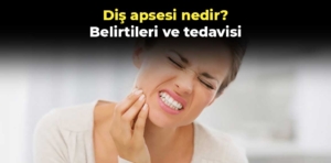 Diş apsesi nedir? Belirtileri ve tedavisi