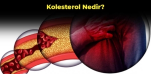 Kolesterol nedir? Kolesterol belirtileri nelerdir?