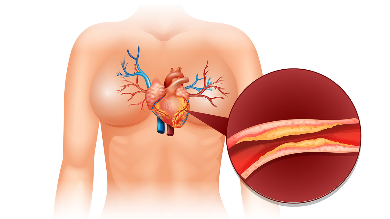 Kolesterol nedir