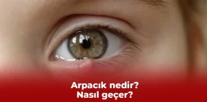 Arpacık nasıl geçer?