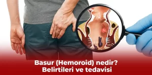 Basur (Hemoroid) nedir? Belirtileri ve tedavisi