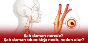 Şah damarı nerede? Şah damarı tıkanıklığı nedir, neden olur?