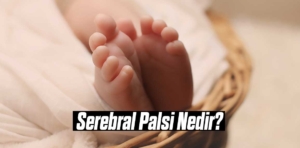 Serebral Palsi Nedir?