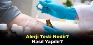 Alerji Testi Nedir ve Nasıl Yapılır?