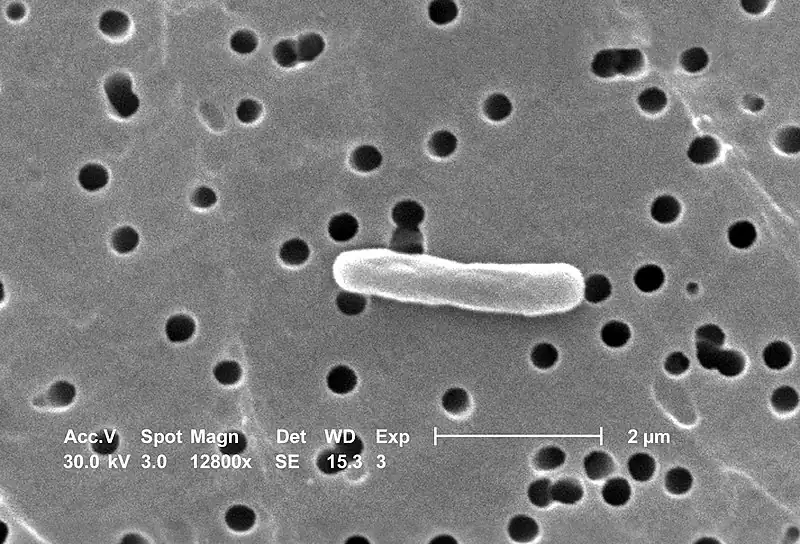 E. Coli(Koli Basili) Nedir Nasıl Bulaşır