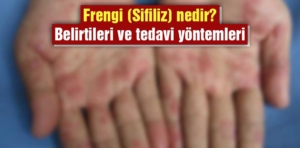 Frengi (Sifiliz) nedir? Belirtileri ve tedavi yöntemleri