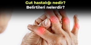 Gut hastalığı nedir, belirtileri nelerdir?