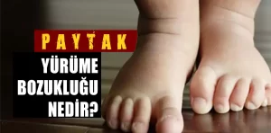 Paytak yürüme bozukluğu nedir? Tedavisi var mı?