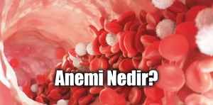 Anemi Nedir?