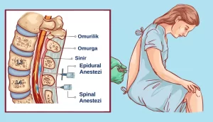 Anestezi nedir? Sağlığa zararı var mıdır?