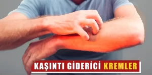 Kaşıntı giderici kremler nelerdir?