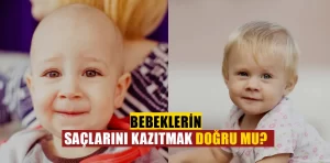 Bebeklerin saçını kazıtmak doğru mu, yanlış mı?