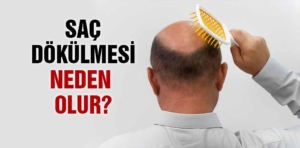 Saç dökülmesi neden olur? Saç dökülmesine ne iyi gelir?