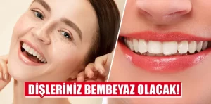 Dişleriniz bembeyaz olacak!