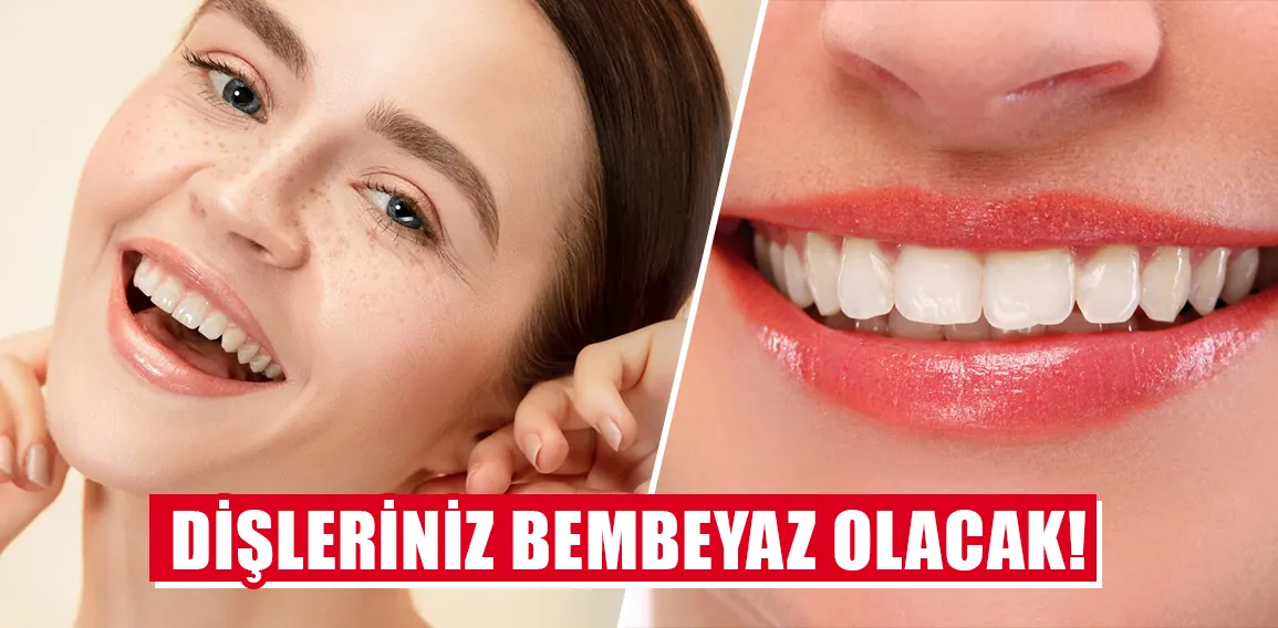 Dişleriniz bembeyaz olacak! Diş