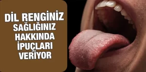 Dil Rengi Sağlığınız Hakkında Ne Söylüyor?