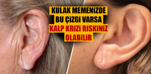 Kulak memenizde bu çizgi varsa kalp krizi riskiniz olabilir