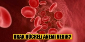 Orak hücreli anemi nedir?