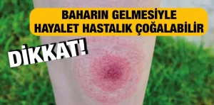 Baharda sık gözüken hayalet hastalığına dikkat!