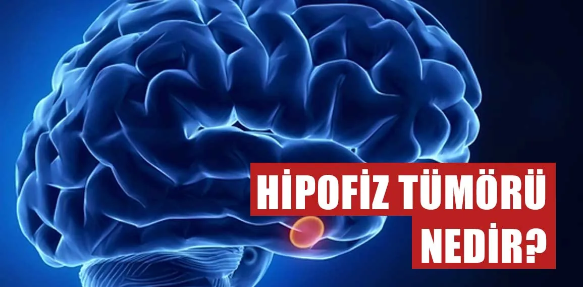 Hipofiz tümörü belirtileri nelerdir?